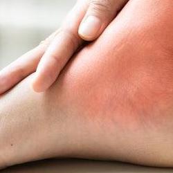 발목염좌 산재, 2주만에 돈 챙긴 알바생 사례 충격