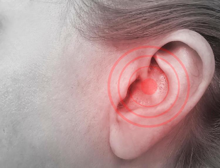 귀 이명 치료 방법, 2달 만에 사라진 충격 후기